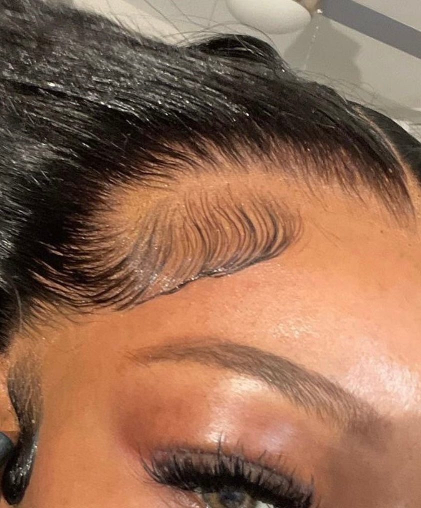 Frontals/Closures
