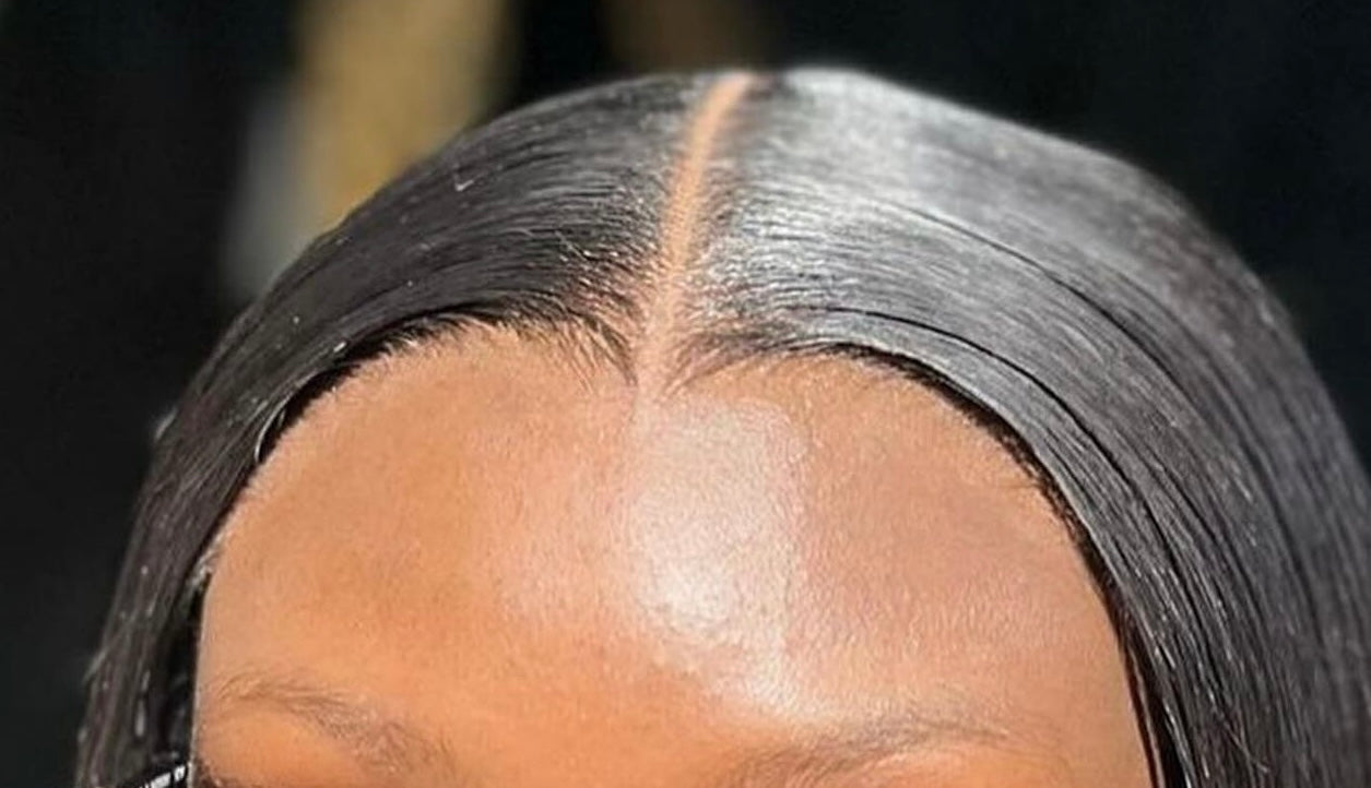 Frontals/Closures